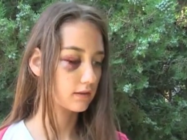 Мъж нападна без причина и преби 13-годишно момиче посред бял