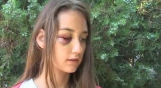 Мъж нападна без причина и преби 13 годишно момиче посред бял