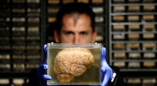 Резултатите от най широкомащабното извършвано някога изследване върху функционирането на мозъка