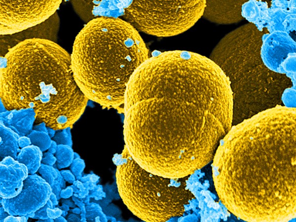 Учени от Калифорнийския университет в Бъркли, САЩ създадоха бактерии, които