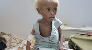 Йемен страда от най тежката хуманитарна криза на планетата Два милиона