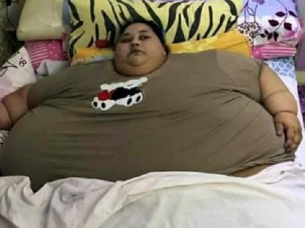 Египтянката Иман Ахмад Абдулати, смятана за най-дебелата жена в света,