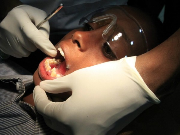 Травмите на зъбите възникват още в най-ранните етапи от развитието